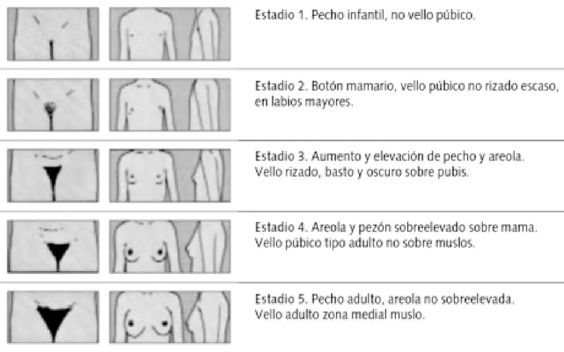 Imagen del artículo