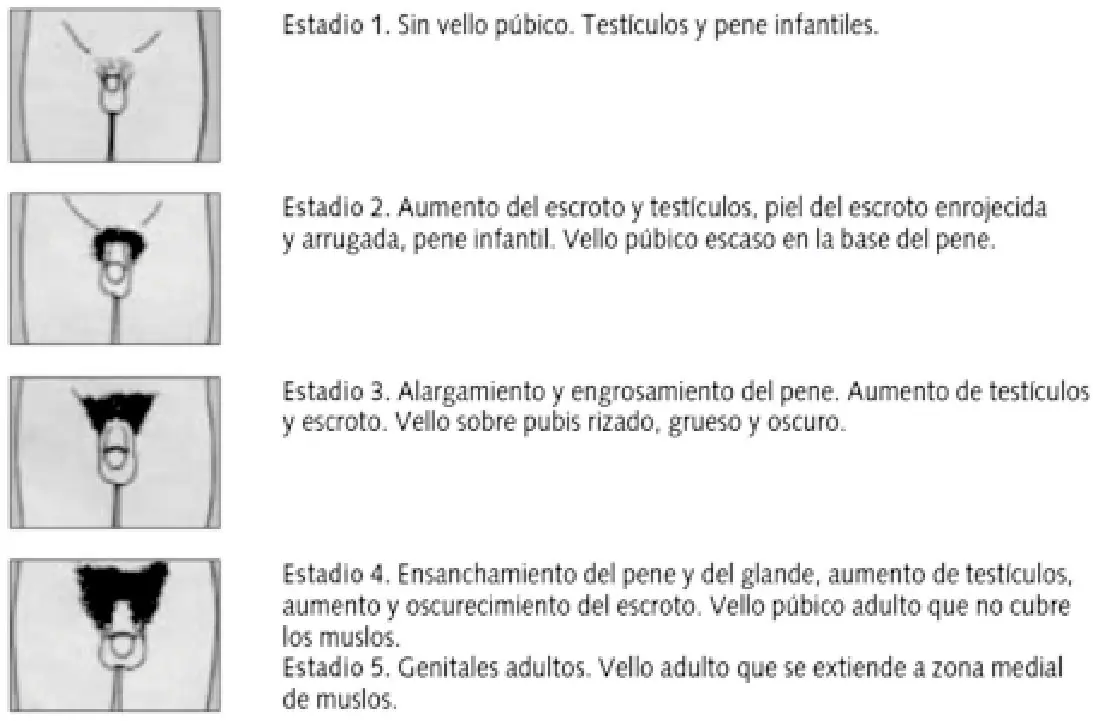 Imagen del artículo